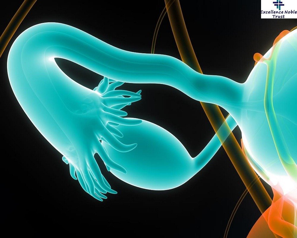 Blocked Tubes Treatment in West Delhi Blocked Tubes Treatment in West Delhi