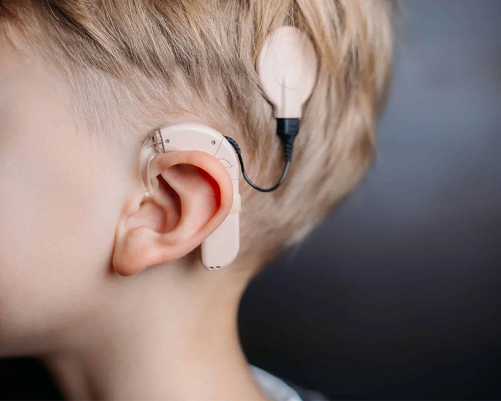 Cochlear Implant Surgery in West Delhi