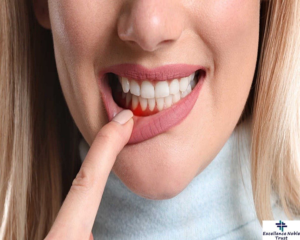 Periodontists Treatment in West Delhi