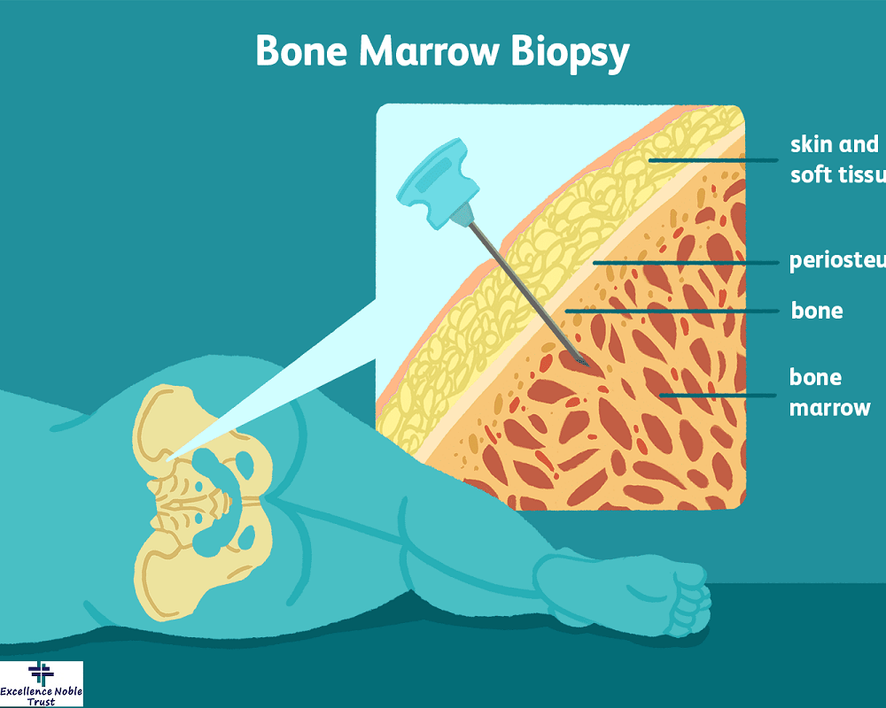 Spinal Biopsy Treatment in West Delhi