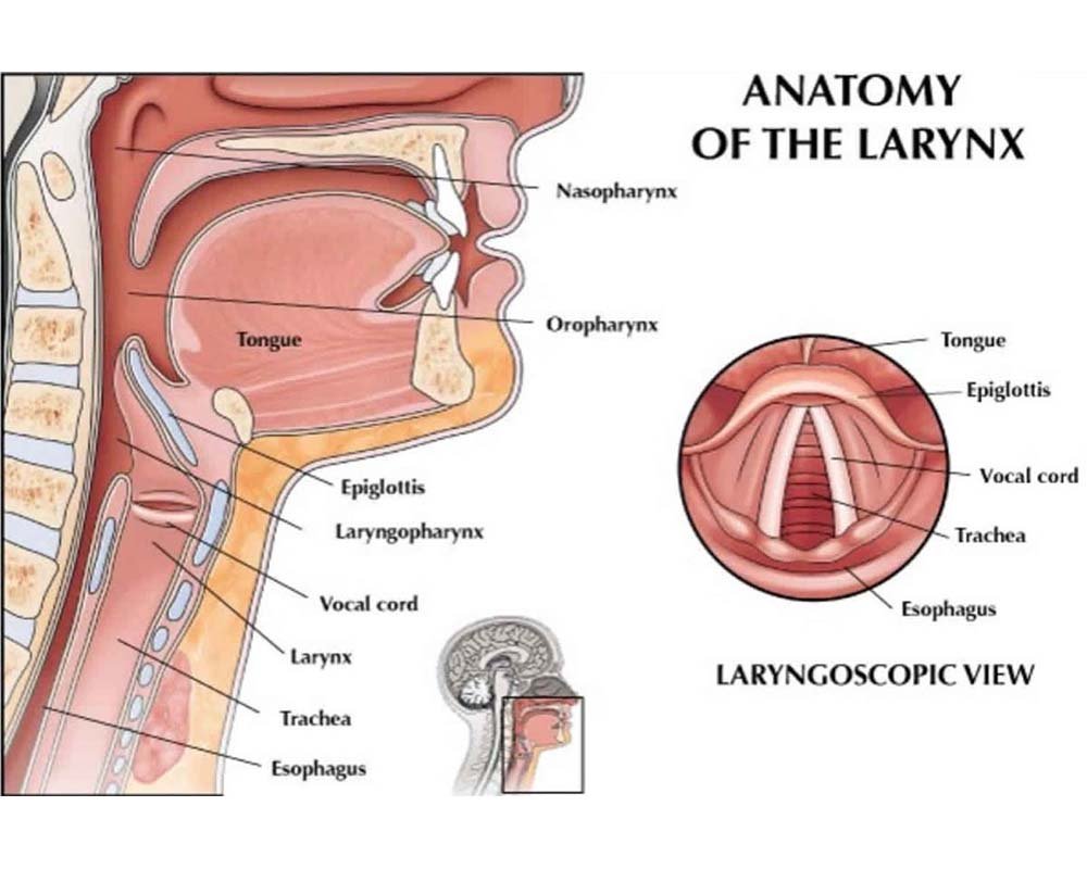 Thyroplasty Surgery in West Delhi